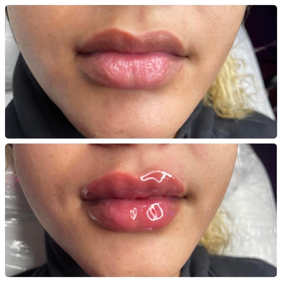Book Lip Slay 1 ML (Lasts up to 9 Months) 30 Minutes