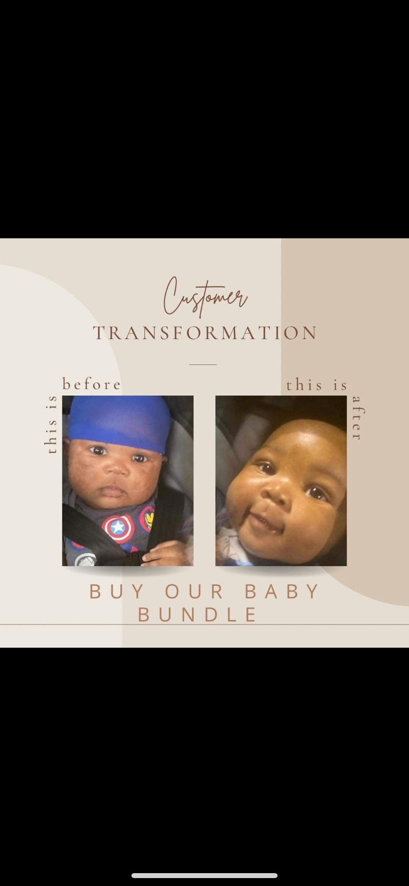 Baby Genotype Bundle Deal