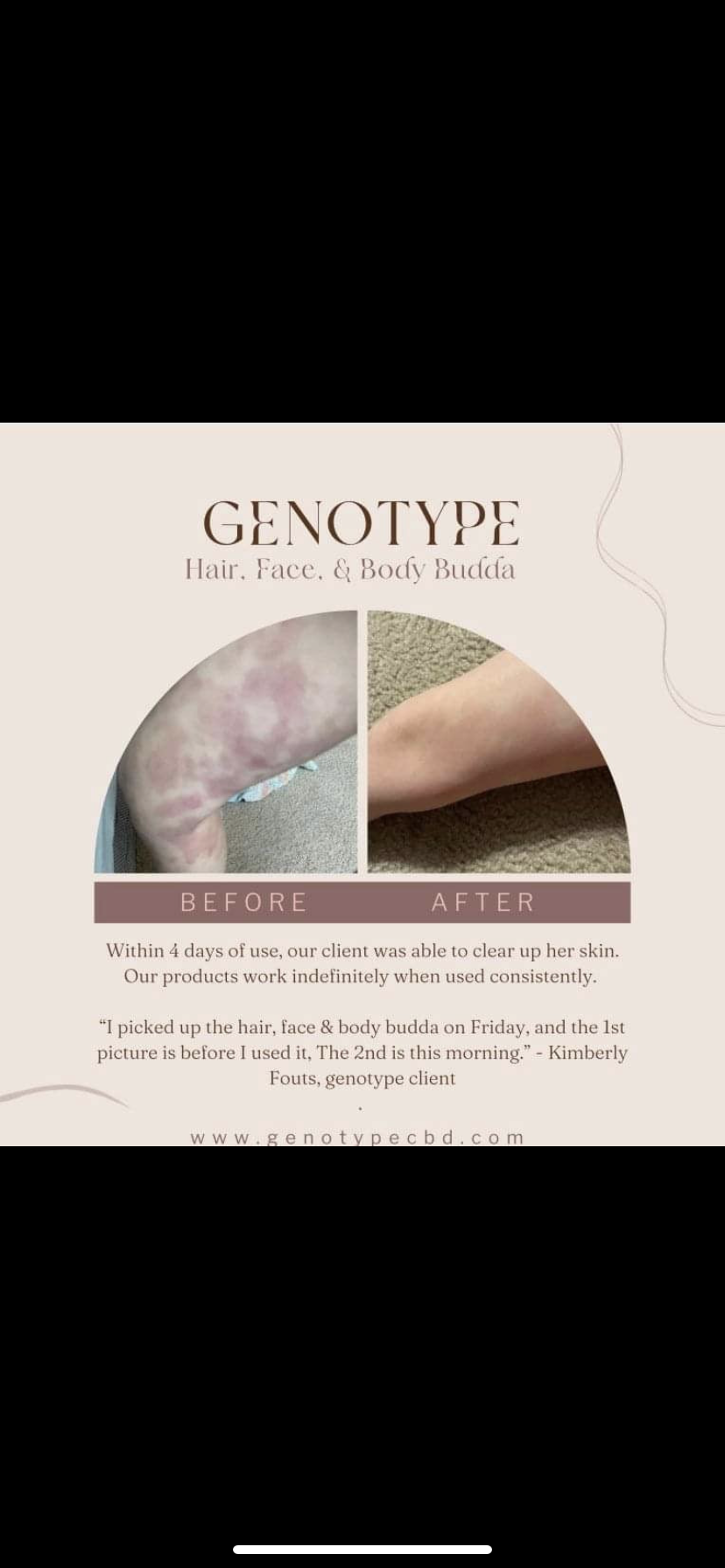 Eczema & Psoriasis Face, Hair, Body Budda