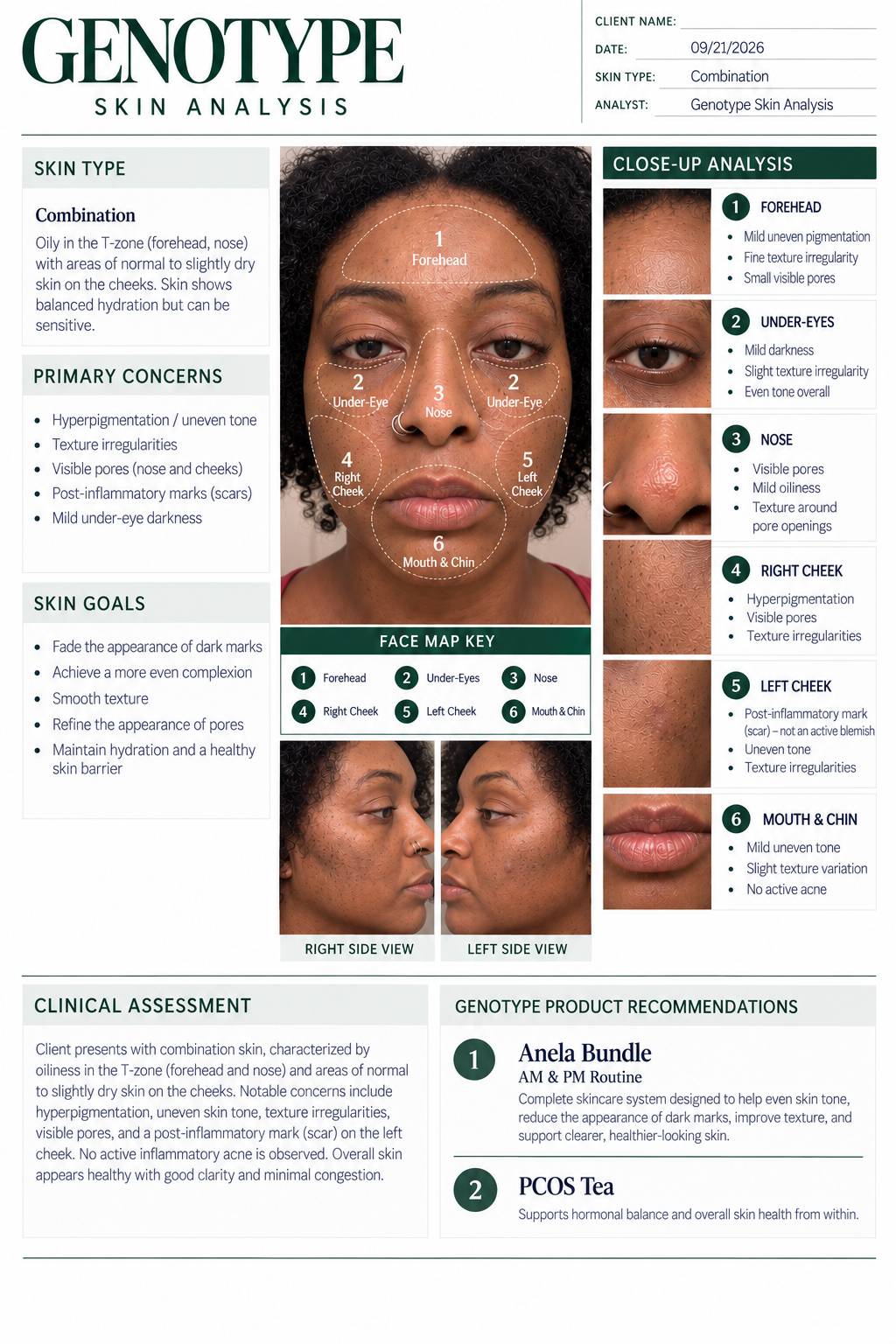 Skin Analysis