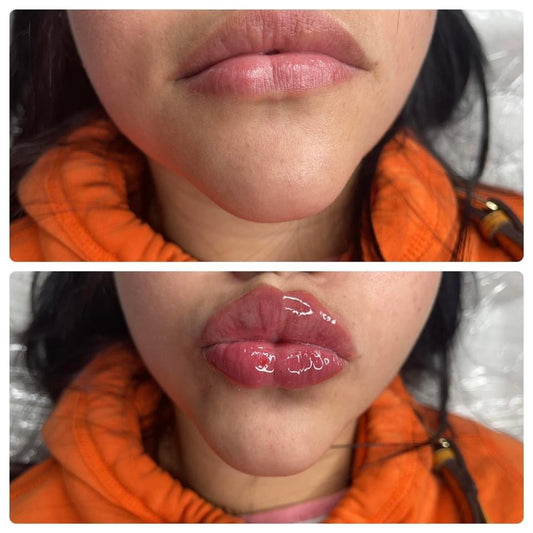 Lippy Lovez Luscious Lips 1 ML (Lasts up to 6-9 Months)