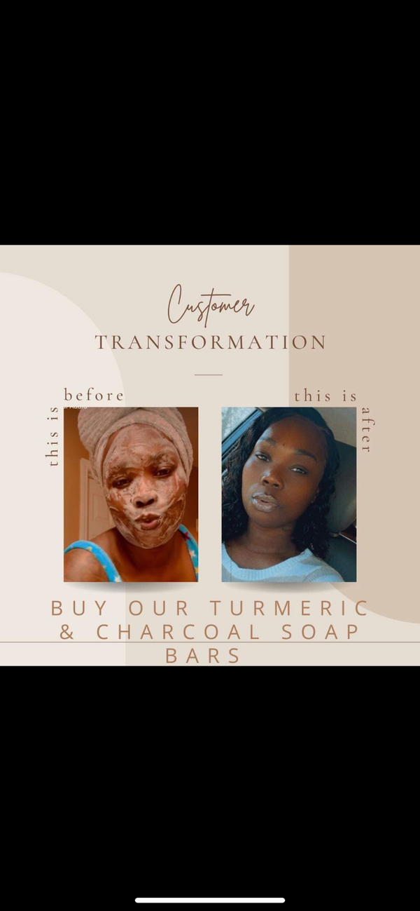 TURMERIC, HONEY, CHARCOAL CLAY MASK