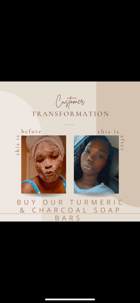 Genotype TURMERIC, HONEY, CHARCOAL CLAY MASK