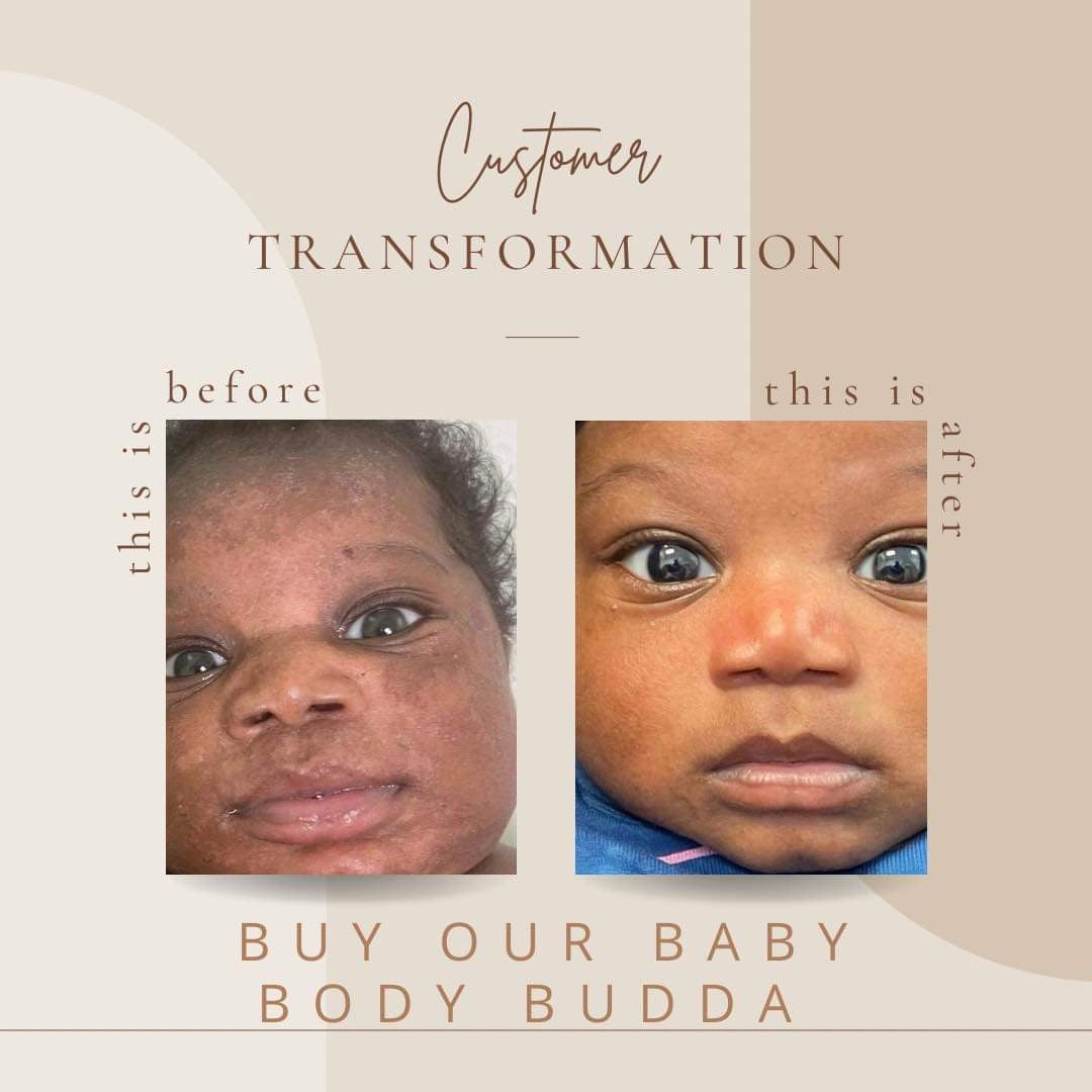 Baby Genotype Hair•Face•Body Budda